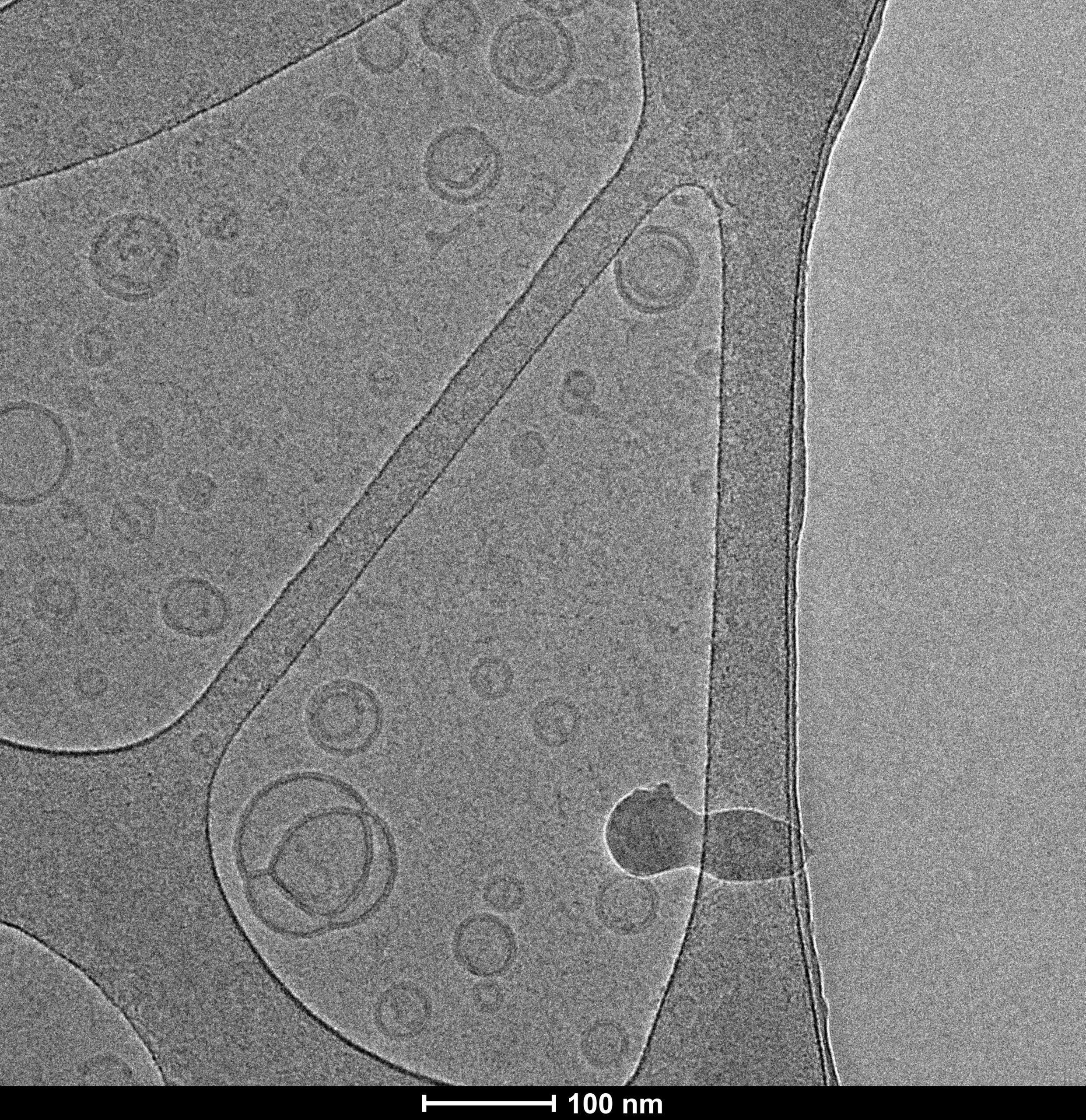 תמונת מיקרוסקופ אלקטרונים (TEM) של Liposomalix D, מרכז למיקרוסקופיית אלקטרונים של חומרים רכים, הטכניון