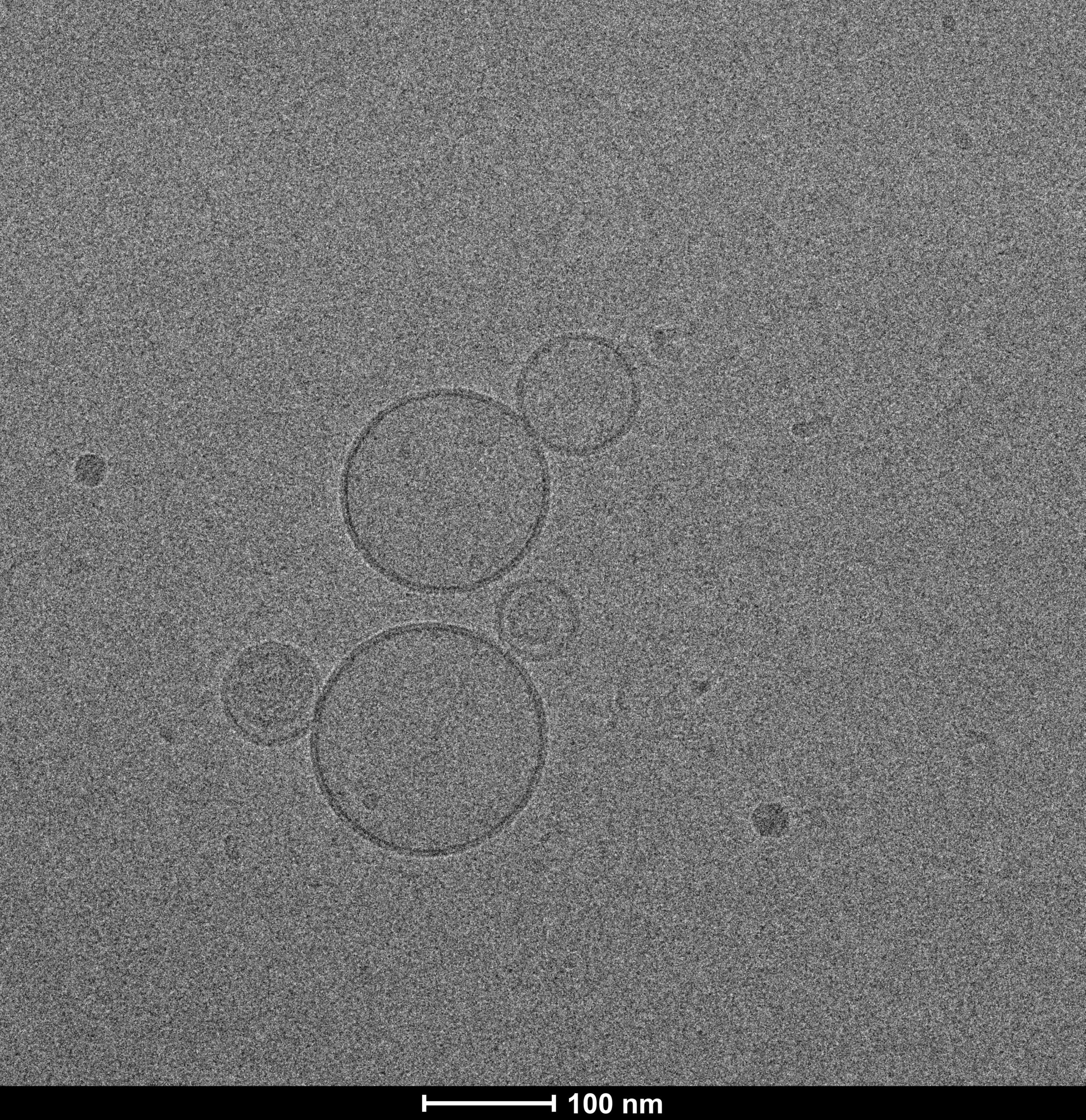 תמונת מיקרוסקופ אלקטרונים (TEM) של מגנזיום ציטראט Liposomalix, מרכז למיקרוסקופיית אלקטרונים של חומרים רכים, הטכניון