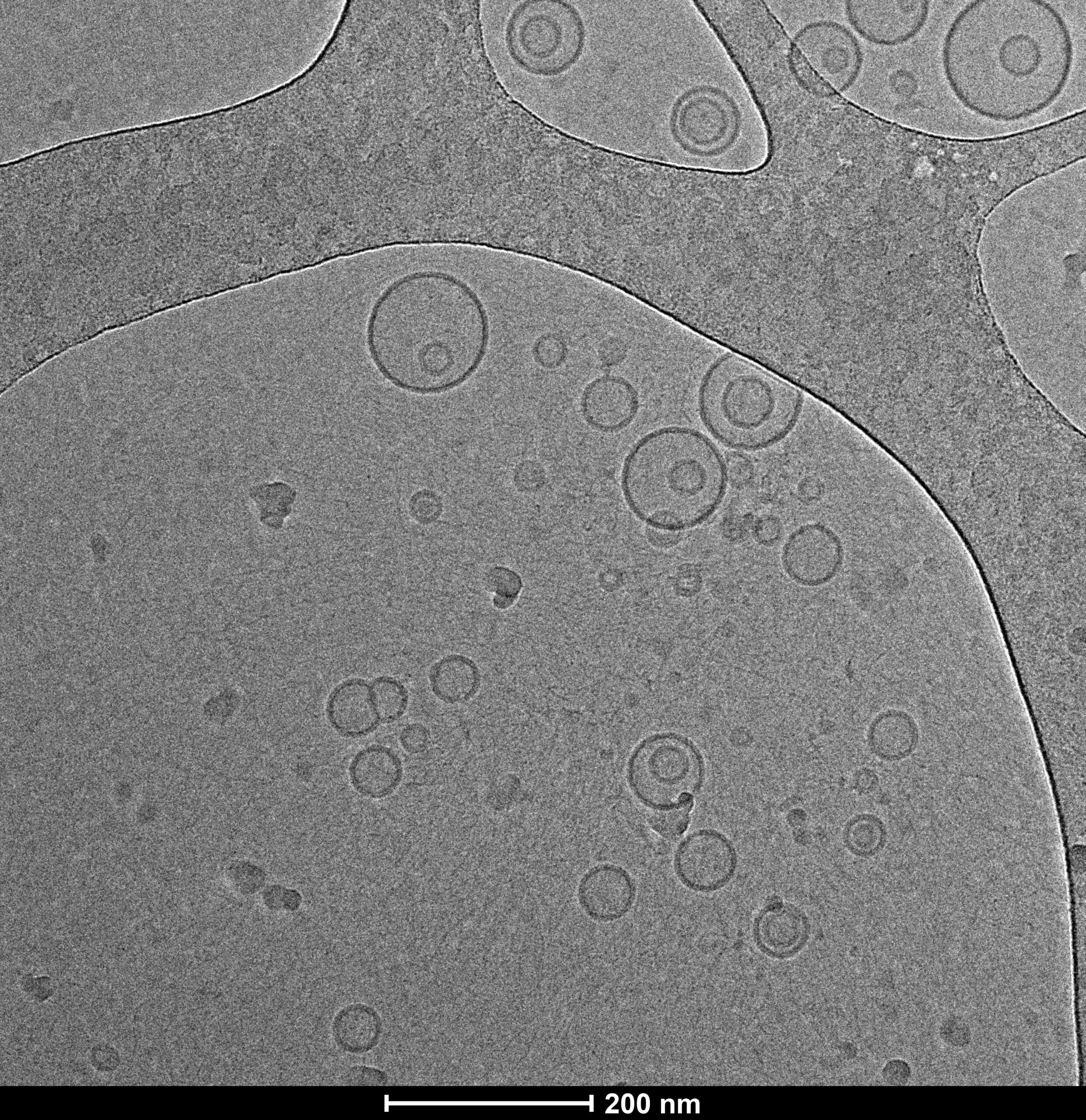 תמונת מיקרוסקופ אלקטרונים (TEM) של Liposomalix C, מרכז למיקרוסקופיית אלקטרונים של חומרים רכים, הטכניון
